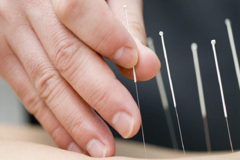 Acupunctuur beter tegen knieartrose dan chirurgie