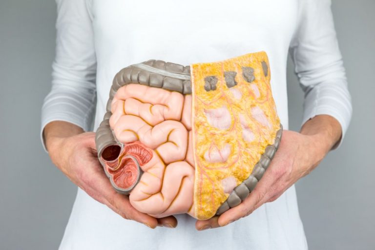 Voedselvergiftiging zou jaren later ziekte van Crohn kunnen veroorzaken